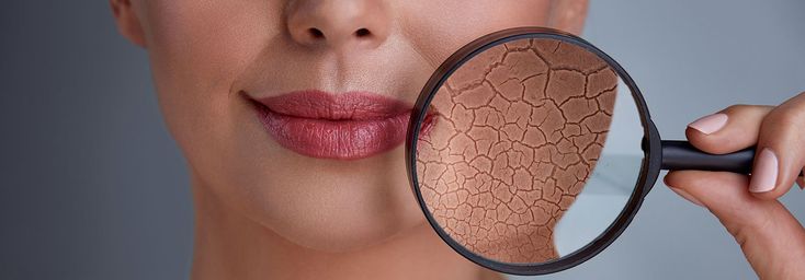 چرا پوست خشک زودتر پیر می‌شود؟