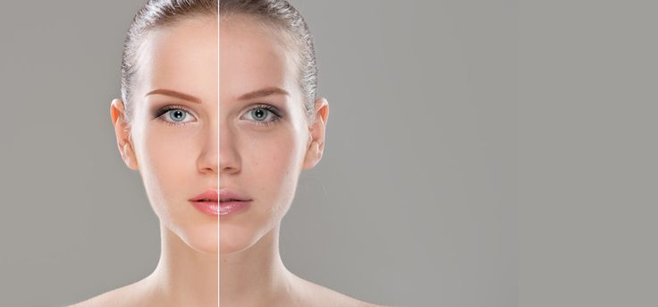 عادت های روزانه برای بهبود کیفیت پوست 