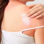 چگونه می توان از آفتاب سوختگی جلوگیری کرد؟