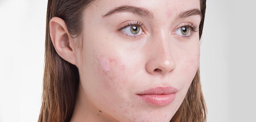 چرا پوستم تیره شده است؟