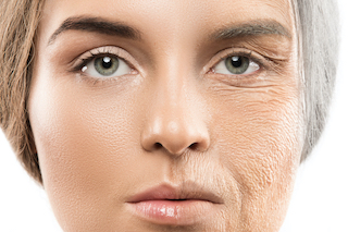 تغییرات پوست در دوران یائسگی چگونه است؟