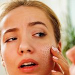 اصول مراقبت از پوست در برابر تغییرات هورمونی