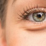بررسی دلایل و راهکارهای رفع پف زیر چشم