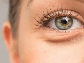 بررسی دلایل و راهکارهای رفع پف زیر چشم