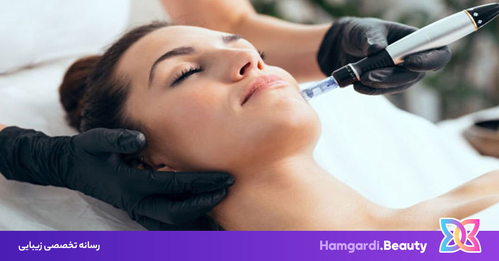 میکرونیدلینگ، روشی موثر برای جوانسازی و بهبود پوست