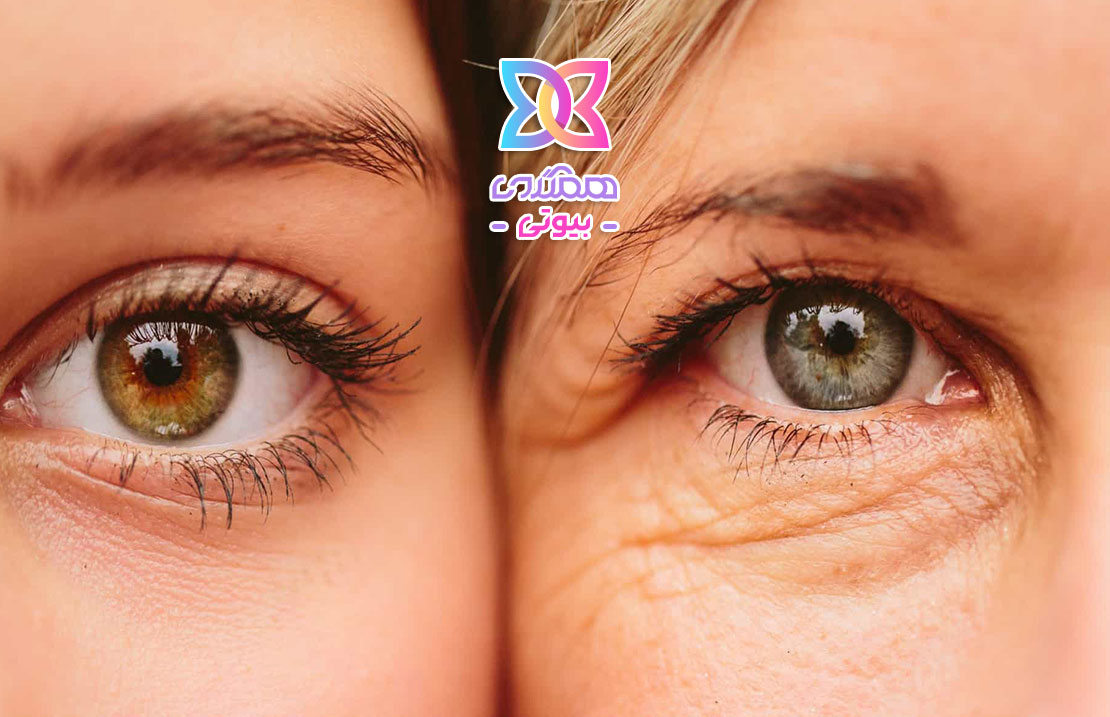 مراقبت از پوست دور چشم، راهکارهایی برای حفظ زیبایی و جوانی این ناحیه حساس