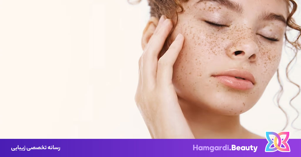 کاهش تیرگی پوست + 5 ماسک شگفت آور