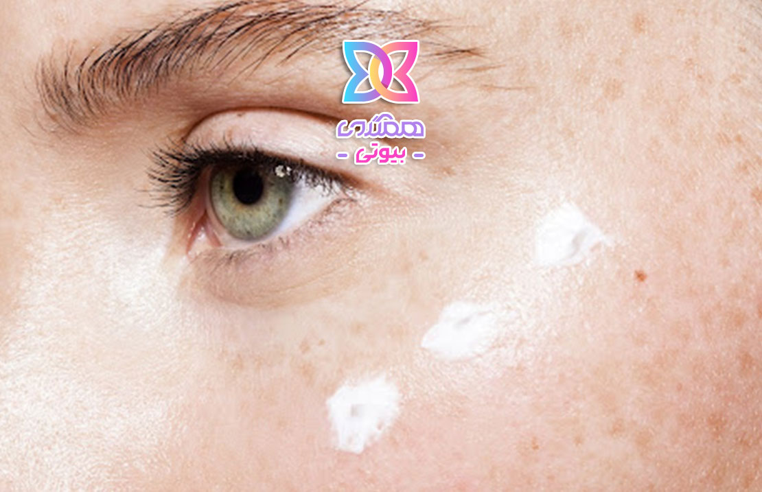 کاهش تیرگی پوست + 5 ماسک شگفت آور