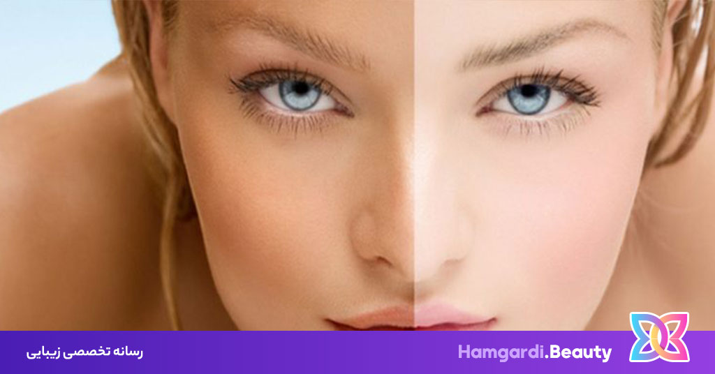 محلول روشن کننده پوست ، راهی برای داشتن پوست درخشان و بدون لک