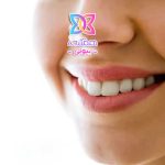 درمان خط لبخند، روش‌های موثر برای کاهش و از بین بردن خطوط کنار دهان