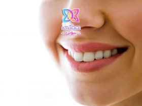 درمان خط لبخند، روش‌های موثر برای کاهش و از بین بردن خطوط کنار دهان