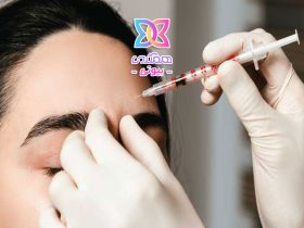 چه زمانی بهترین سن استفاده از بوتاکس است؟